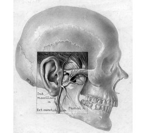 Ankylosis of the jaw; skull showing location and anatomy under incision. Publication/Date: Surg., Gynec. And Obst., Nov. 1918. Author: Gordon B. New, MD © Mayo Clinic Foundation for Medical Education and Research.